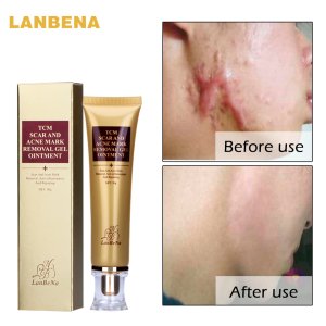 LANBENA Hot Sell 30ml Skin Care Dark Spot Whitening Acne Mark Scar Removal Cream Gel
